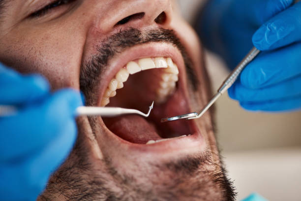 Best Chipped Tooth Repair Near Me  in Mcleansville, NC